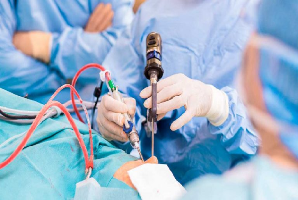 Endoscopic Surgery